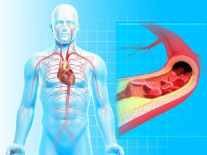 Boala Arterială Coronariană (BAC): Ești în Grupa de Risc?